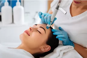 Microdermabrasion