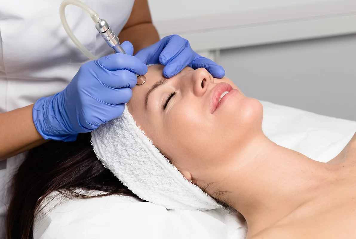 Microdermabrasion